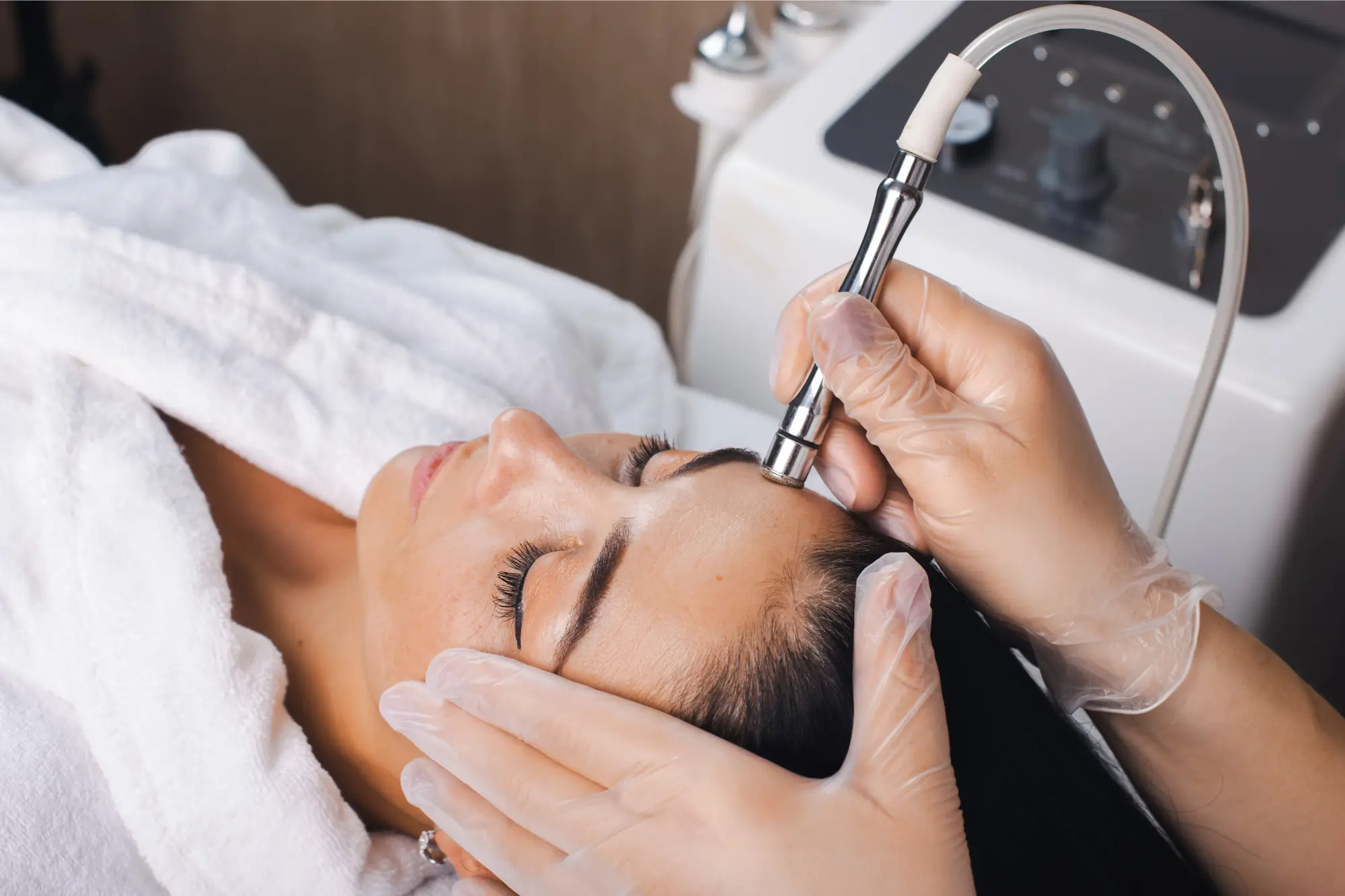 Understanding Microdermabrasion: How It Can Transform Your Skin